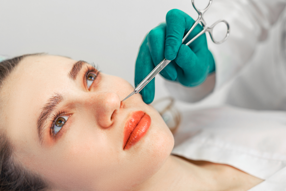 première rhinoplastie